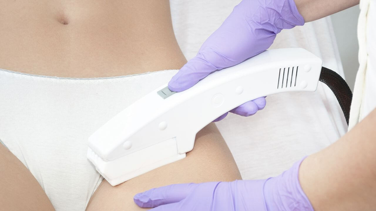 epilare definitiva IPL