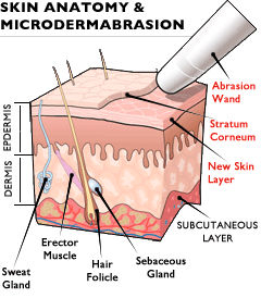 tratament facial cu microdermabraziune
